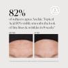 imageNaturium Azelaic Topical Acid 10 Face ampamp Skin Care Beauty Treatment with Niacinamide ampamp Vitamin C 1 oz2 Ounce Pack of 1