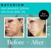 imageNaturium Niacinamide Face Serum 12 Plus Zinc 2 AntiAging Pore Minimizer ampamp Dark Spot Corrector with Hyaluronic Acid ampamp Vitamin E Vegan ampamp CrueltyFree 1 oz1 Fl Oz Pack of 1