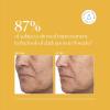imageNaturium Tranexamic Topical Acid 5 Face ampamp Skin Care with Kojic Acid Niacinamide ampamp Licorice Root 1 oz1 Fl Oz Pack of 1